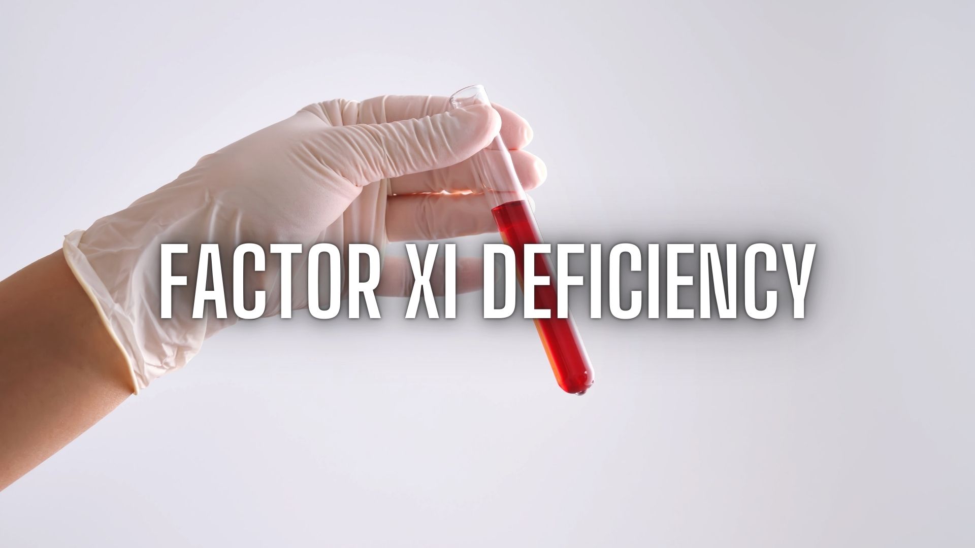 Factor XI Deficiency